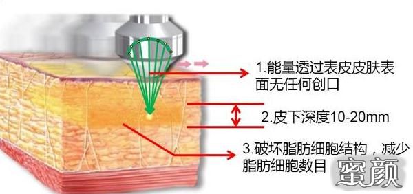 案例图片