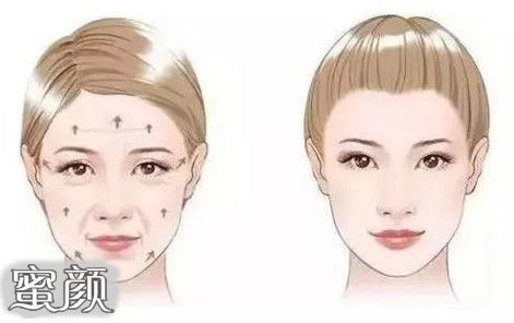 https://img.miyanlife.com/mnt/Editor/2021-05-17/60a255c532af3.jpg