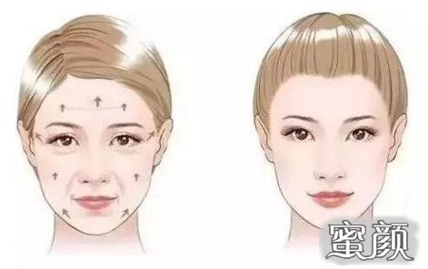 https://img.miyanlife.com/mnt/Editor/2021-05-22/60a8fd86bc0f4.jpg