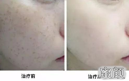 https://img.miyanlife.com/mnt/Editor/2021-05-22/60a8fdd859022.jpg