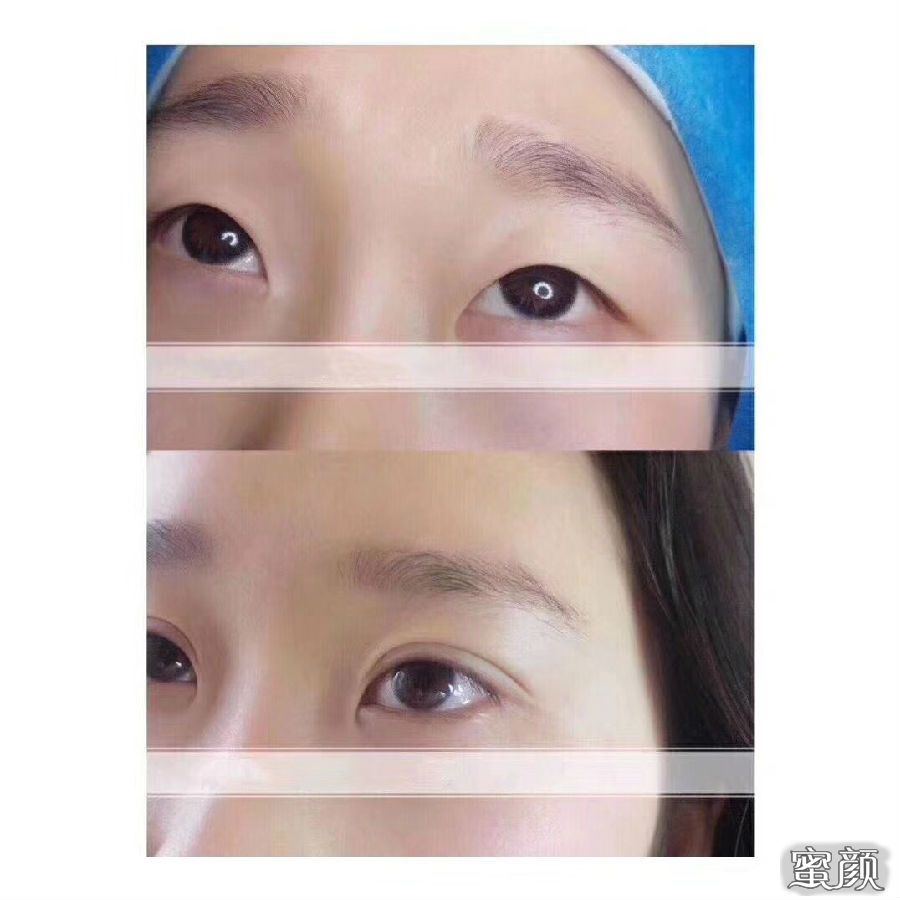 https://img.miyanlife.com/mnt/Editor/2021-05-23/60aa2e3acb57b.jpg