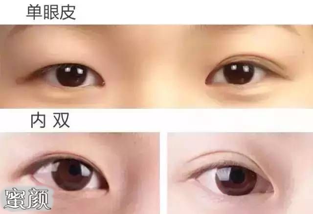 https://img.miyanlife.com/mnt/Editor/2021-05-23/60aa2e47e554a.jpg
