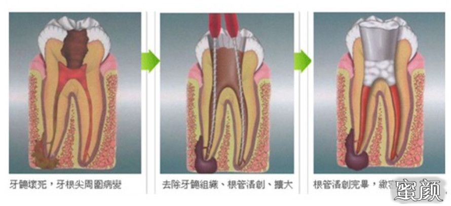 案例图片