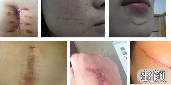 https://img.miyanlife.com/mnt/Editor/2021-05-28/60b04494edad5.jpg