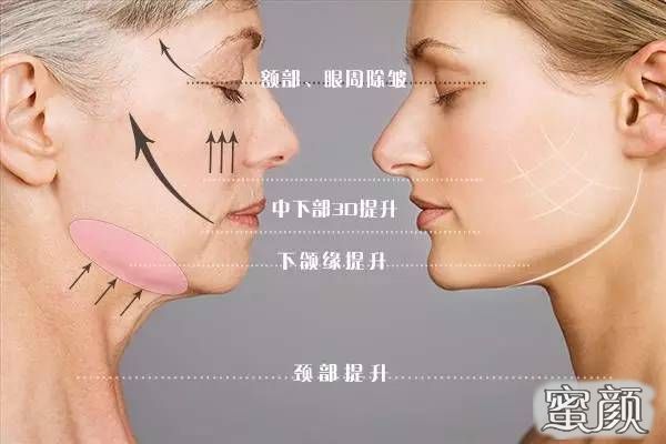 https://img.miyanlife.com/mnt/Editor/2021-05-31/60b43fdc12c81.jpg