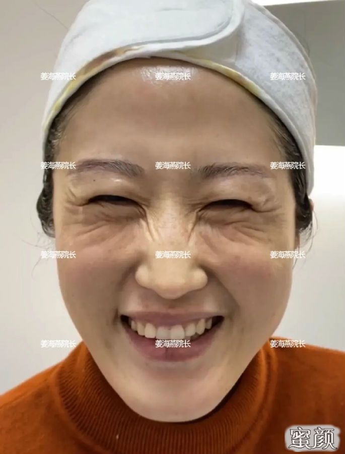 https://img.miyanlife.com/mnt/Editor/2021-06-04/60b9ff042f780.jpg