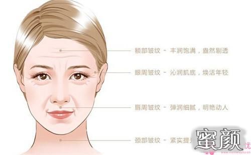 https://img.miyanlife.com/mnt/Editor/2021-06-05/60bb1afa79b57.jpg