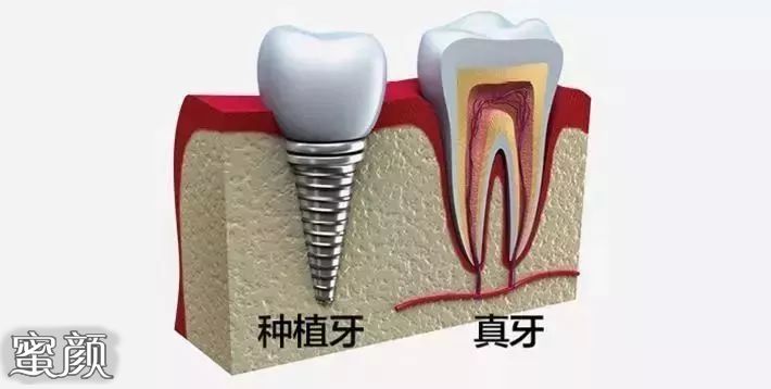 案例图片