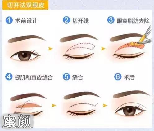 https://img.miyanlife.com/mnt/Editor/2021-06-12/60c4bd6f13069.jpg