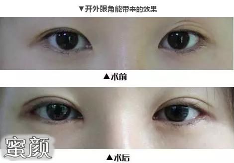 https://img.miyanlife.com/mnt/Editor/2021-06-12/60c4bd7b67e1b.jpg