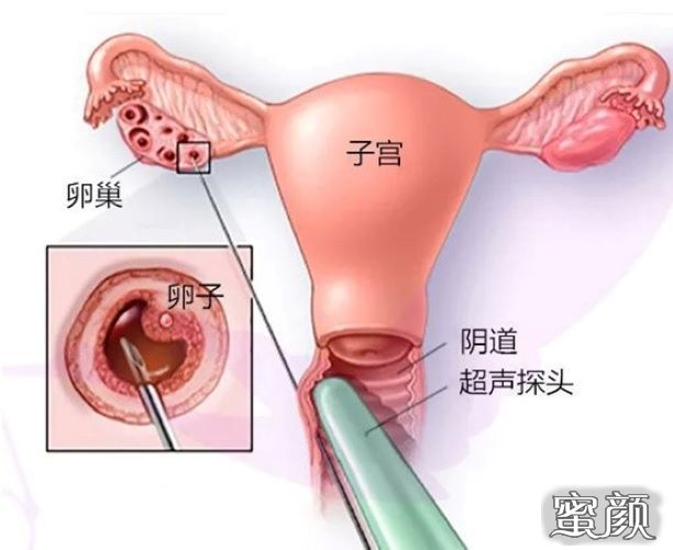 案例图片