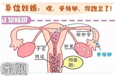 案例图片