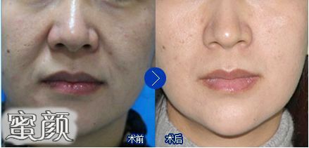 https://img.miyanlife.com/mnt/Editor/2021-06-16/60c9861f2bdc9.jpg