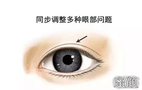 https://img.miyanlife.com/mnt/Editor/2021-07-02/60df1bb46ebf1.jpg