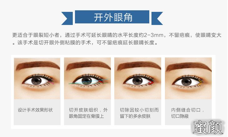 https://img.miyanlife.com/mnt/Editor/2021-07-02/60df1cc2d1858.jpg
