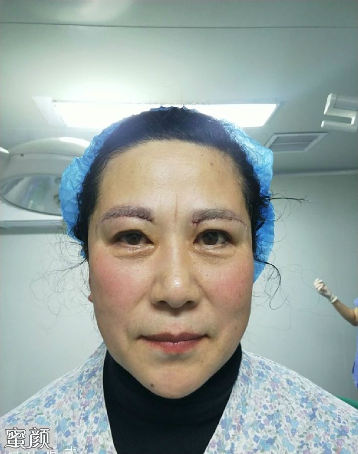 https://img.miyanlife.com/mnt/Editor/2021-07-07/60e52e19d2e14.jpg