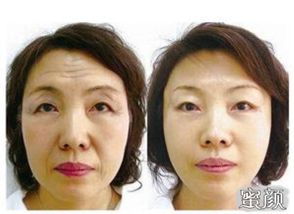 https://img.miyanlife.com/mnt/Editor/2021-07-07/60e5ad7a14eb5.jpg