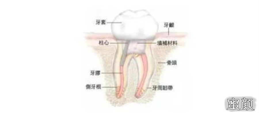 案例图片