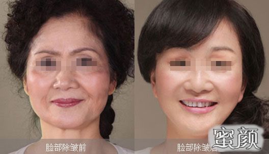 https://img.miyanlife.com/mnt/Editor/2021-07-12/60ebe48003959.jpg