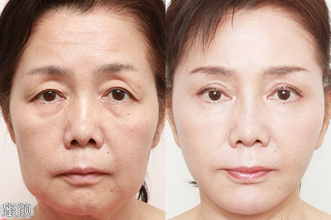 https://img.miyanlife.com/mnt/Editor/2021-07-12/60ebe48b0e6f1.jpg