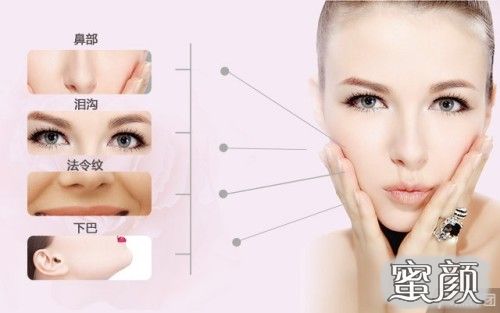 https://img.miyanlife.com/mnt/Editor/2021-07-14/60eea412beb02.jpg