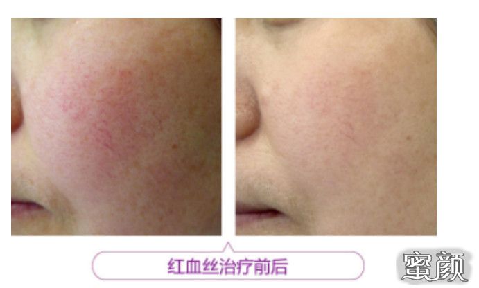 https://img.miyanlife.com/mnt/Editor/2021-07-16/60f0bff05042b.jpg