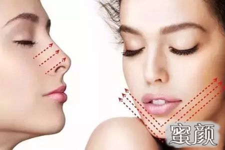 https://img.miyanlife.com/mnt/Editor/2021-07-23/60fab214cc133.jpg