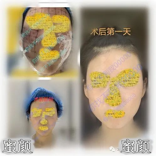 https://img.miyanlife.com/mnt/Editor/2021-07-25/60fd634fad5eb.jpg