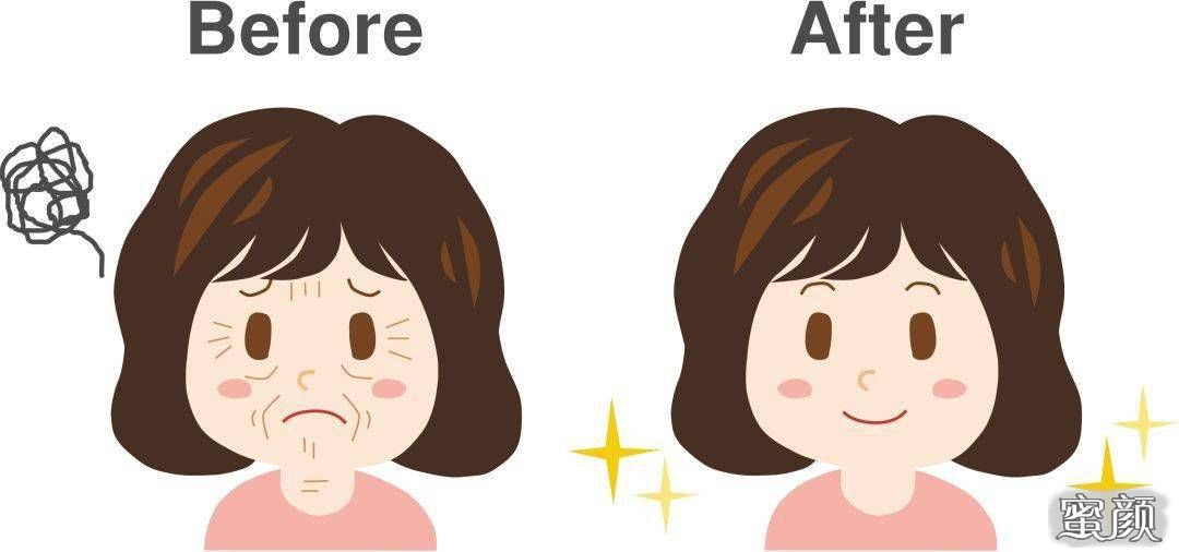 https://img.miyanlife.com/mnt/Editor/2021-07-25/60fd642a6bcd6.jpg
