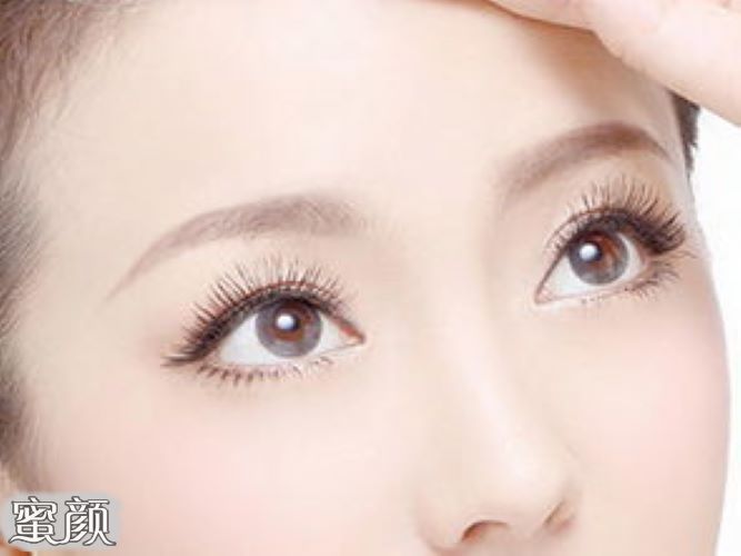 https://img.miyanlife.com/mnt/Editor/2021-07-26/60feb1414c382.jpg
