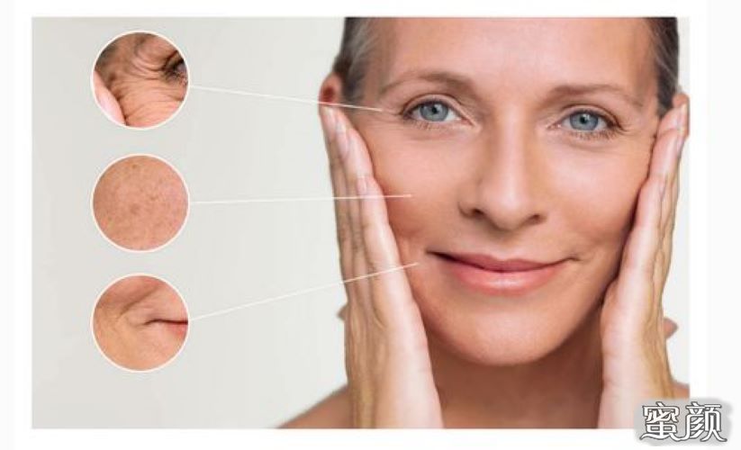 https://img.miyanlife.com/mnt/Editor/2021-08-06/610cd239ef38b.jpg