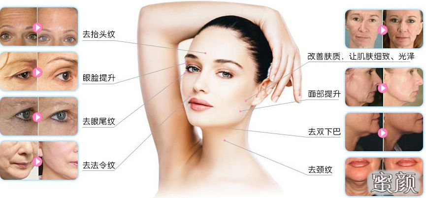 https://img.miyanlife.com/mnt/Editor/2021-08-07/610e063206f7c.jpg