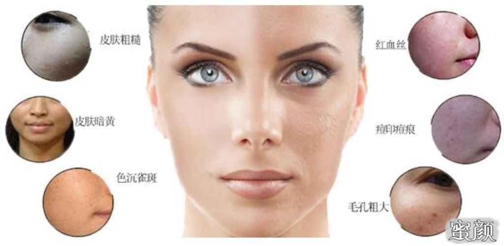 https://img.miyanlife.com/mnt/Editor/2021-08-13/61166e365a1ed.jpg