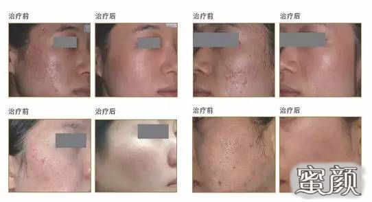 https://img.miyanlife.com/mnt/Editor/2021-08-14/61178ebe1eee3.jpg