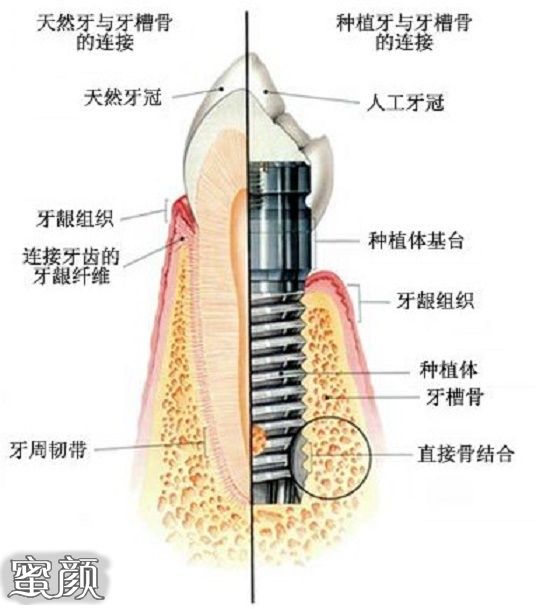 案例图片