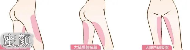 https://img.miyanlife.com/mnt/Editor/2021-08-24/6124b22540985.jpg