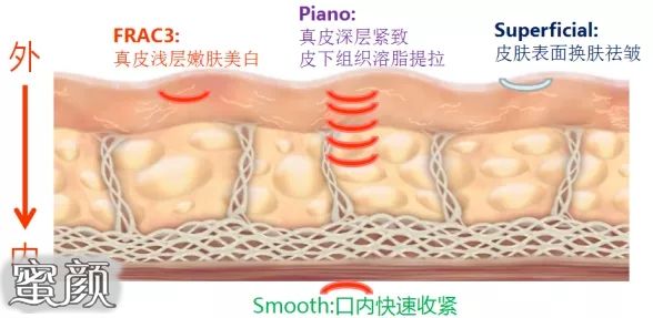 案例图片