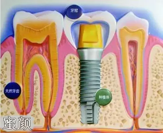 案例图片