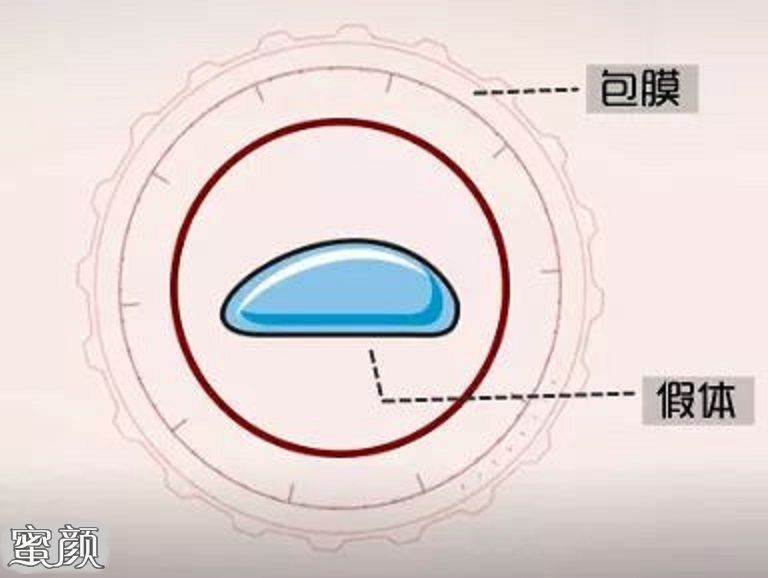 案例图片