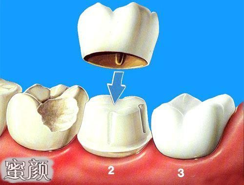 案例图片