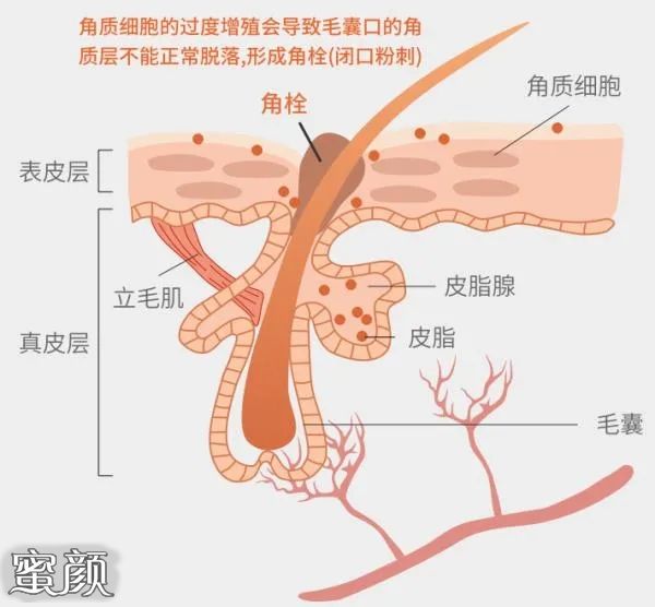 案例图片