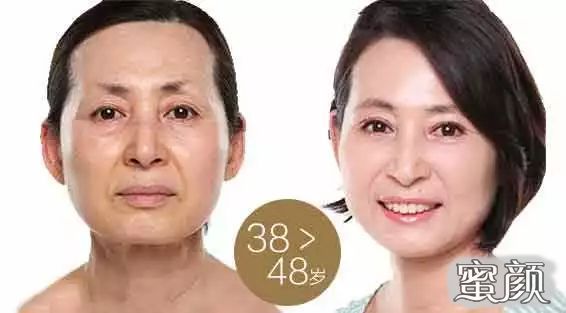 https://img.miyanlife.com/mnt/Editor/2021-11-19/6197a976c9732.jpg