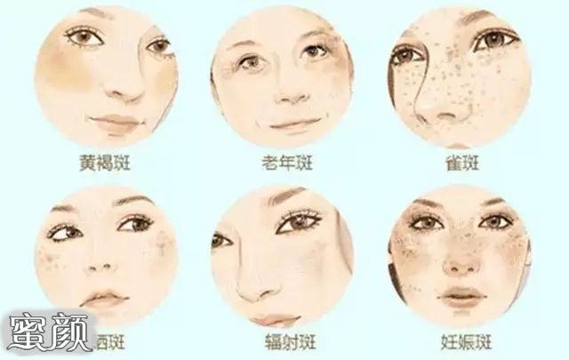 https://img.miyanlife.com/mnt/Editor/2021-11-25/619f2cf3275ed.jpg