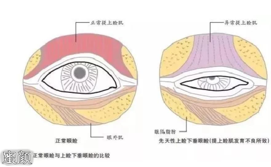 案例图片