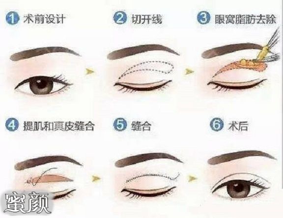 https://img.miyanlife.com/mnt/Editor/2021-12-04/61ab7135de8ec.jpg