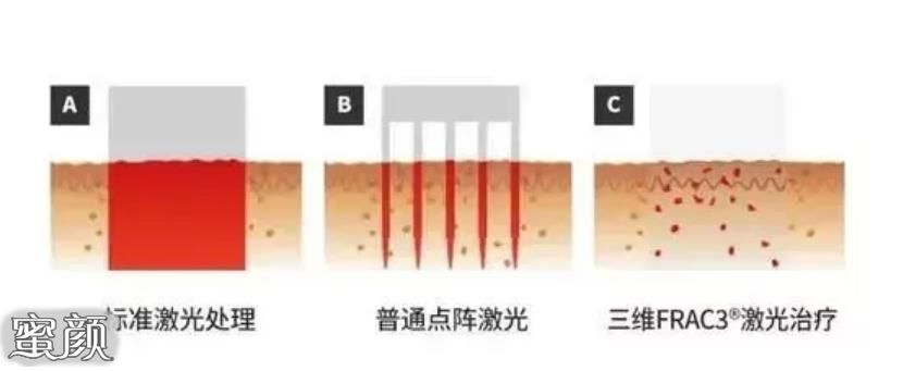 案例图片