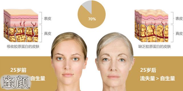 https://img.miyanlife.com/mnt/Editor/2021-12-16/61bad499906fa.jpg