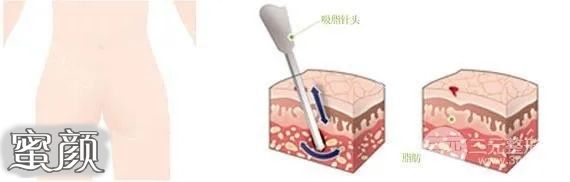 案例图片