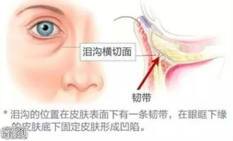 https://img.miyanlife.com/mnt/Editor/2021-12-22/61c2e2f0d71a4.jpg