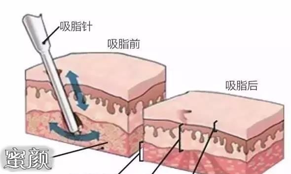 案例图片